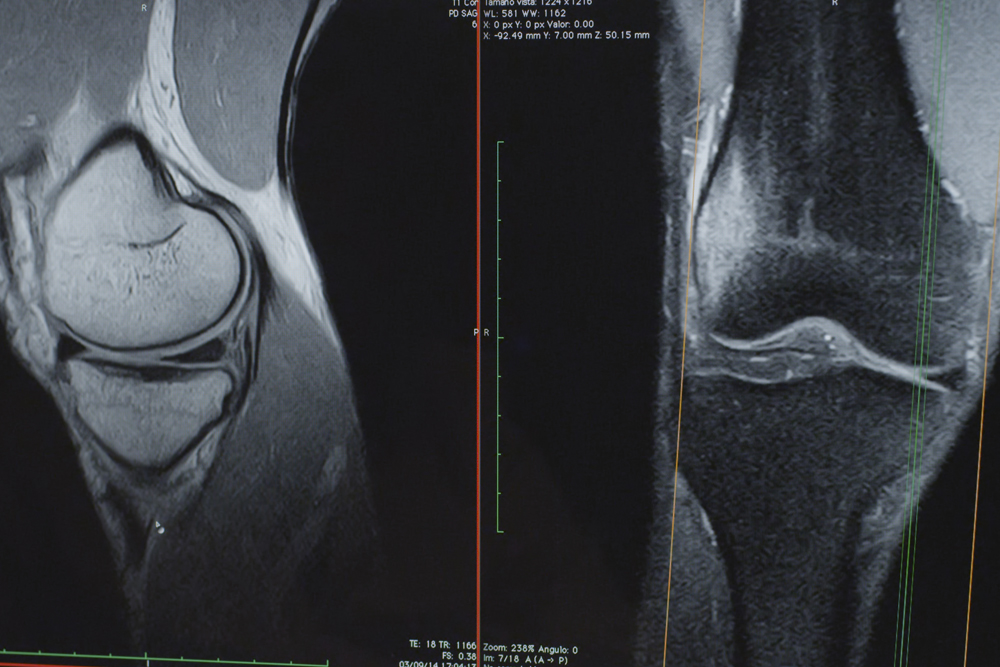 resonancia magentica